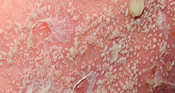 ŧ������м����Ϊ����ҩ�����ǲ���֮ѡ��