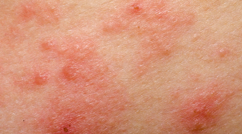 ����Ѫ����֮��������м�����֮�֡����������Ƚ���